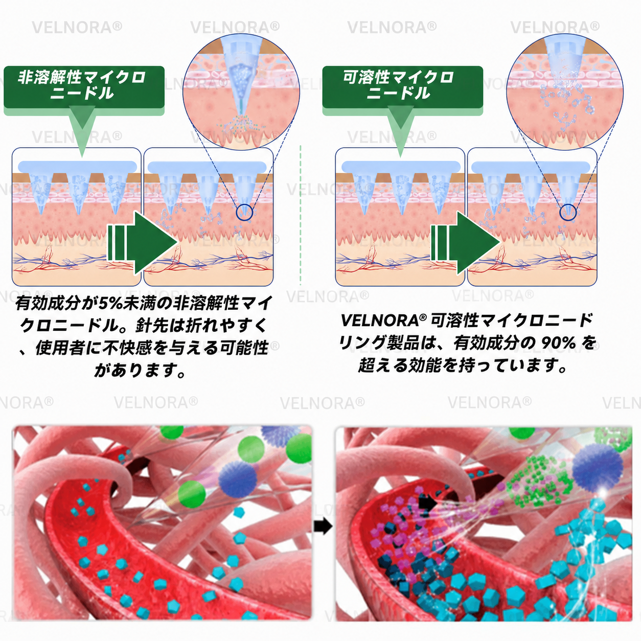 🎉✅【お腹の脂肪・ポッコリ対策に】𝐕𝐄𝐋𝐍𝐎𝐑𝐀® モリンガ＆ベルベリン 10-IN-1 高機能ナノマイクロニードルパッチ（1日1回、7日で変化を実感） 肥満・糖尿病・睡眠時無呼吸症候群・関節の悩み向け